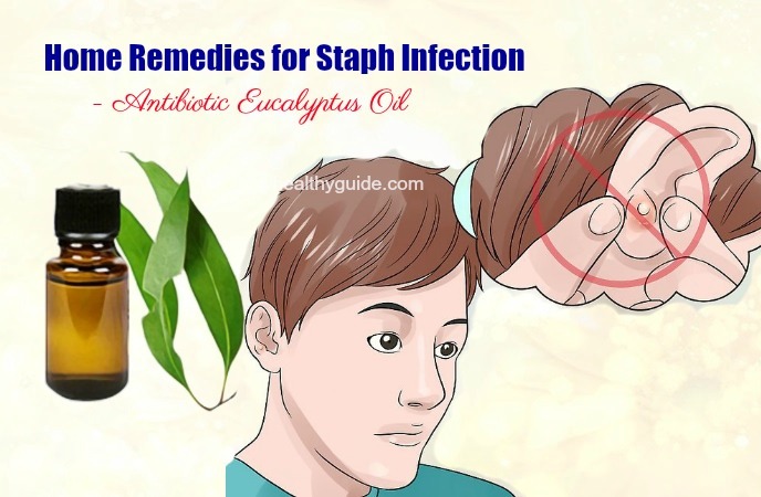 home remedies for staph infection 