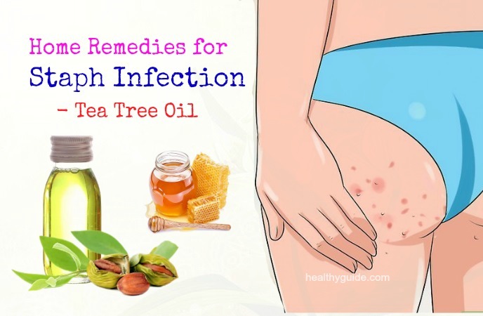 home remedies for staph infection 