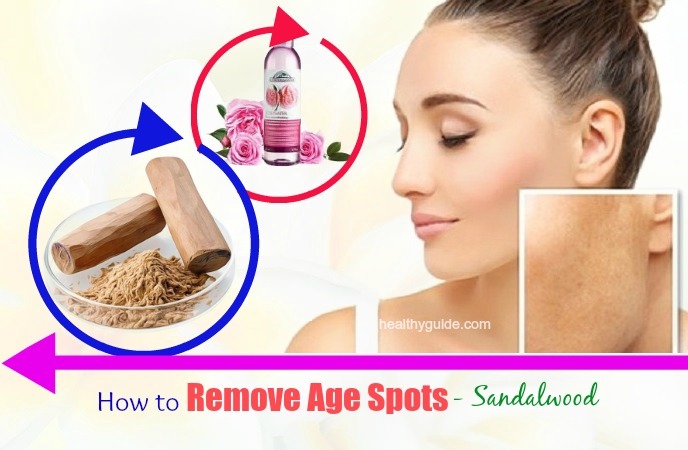 how to remove age spots 