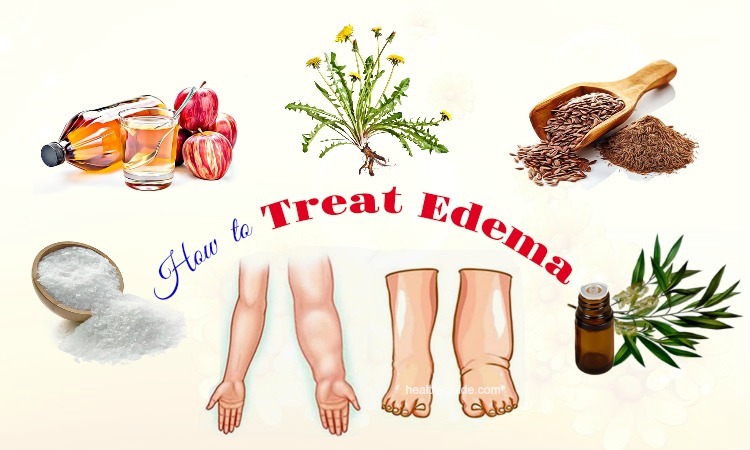 27 Tips How to Treat Edema in Face, Hands, Arms, Feet, Legs, & Knee Naturally