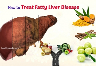 10 Tips How to Treat Fatty Liver Disease Symptoms Naturally at Home with Diet
