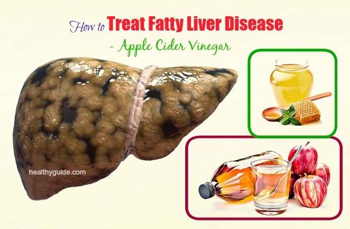 how to treat fatty liver disease