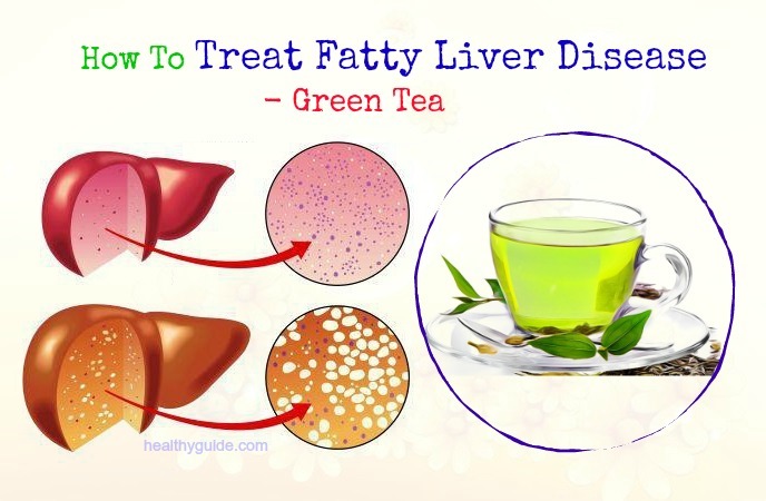 how to treat fatty liver disease