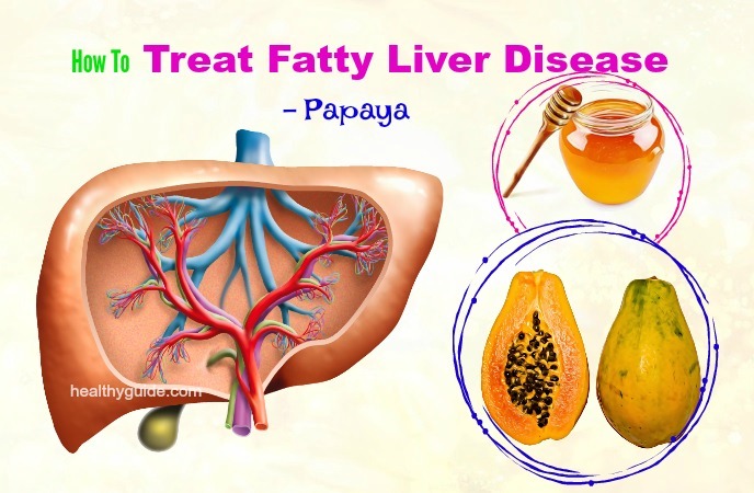 how to treat fatty liver disease 