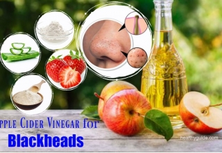 18 Tips How to Use Apple Cider Vinegar for Blackheads and Whiteheads Treatment