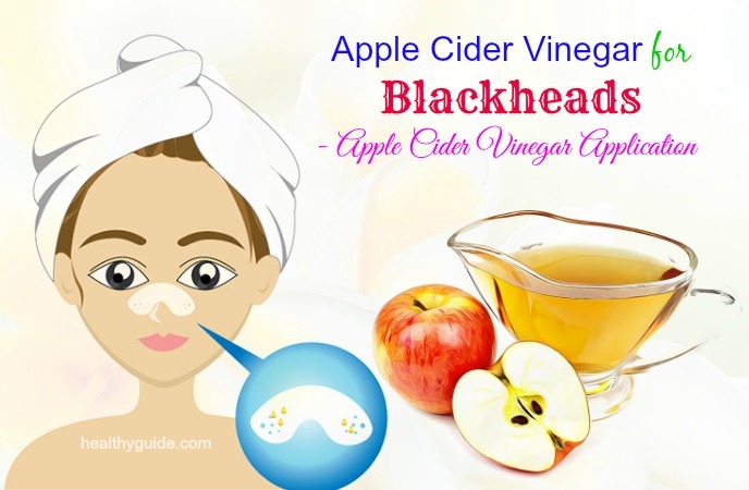 apple cider vinegar for blackheads 